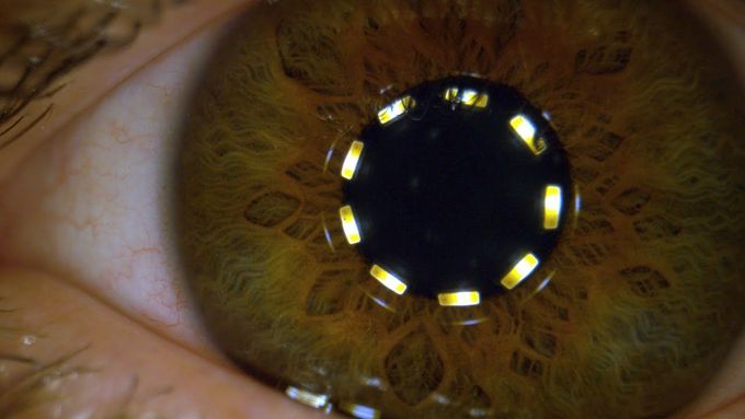 Macro Pupil Constricting in Slow Motion - The Slow Mo Guys