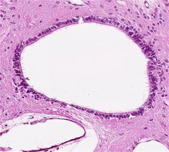 Epithelium of stomach surface