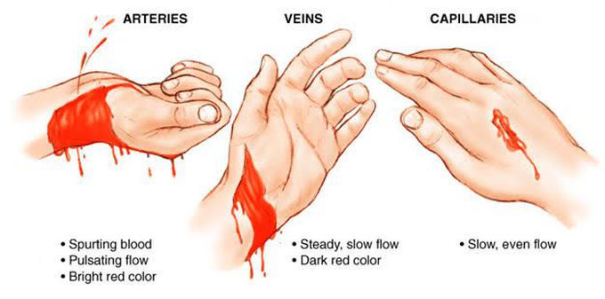 Types of hemorrhages