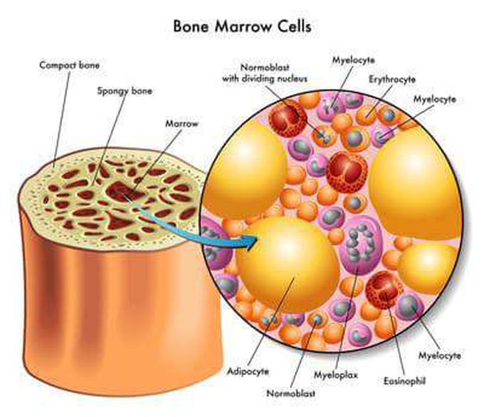 The microscopic view of Bone Marrow smear