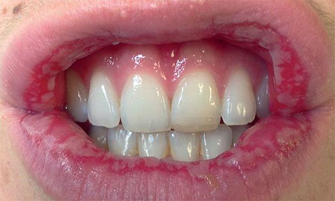 Diagnosis?