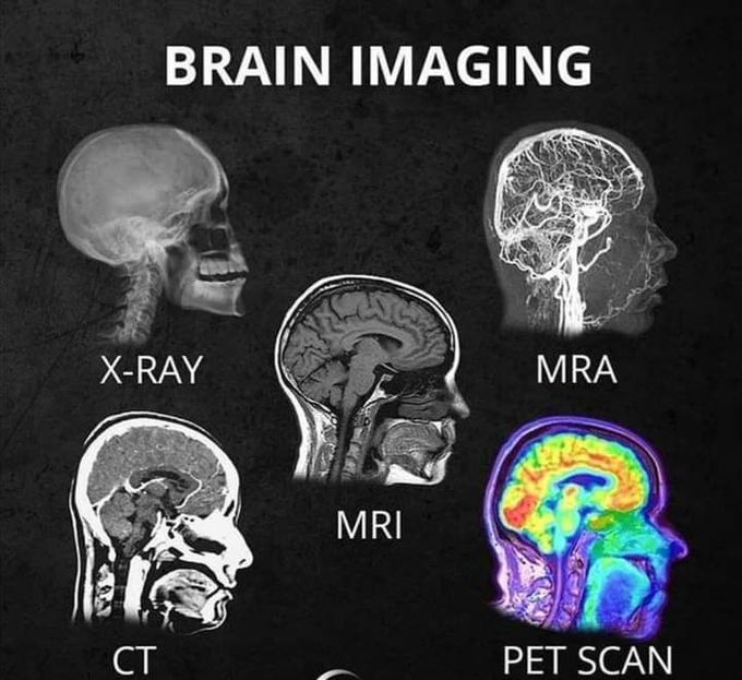 Brain Imaging