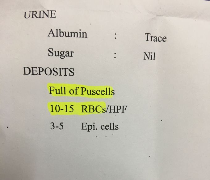 Urine test