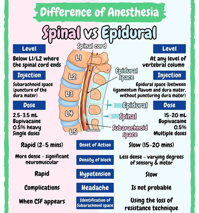 Difference of Anesthesia