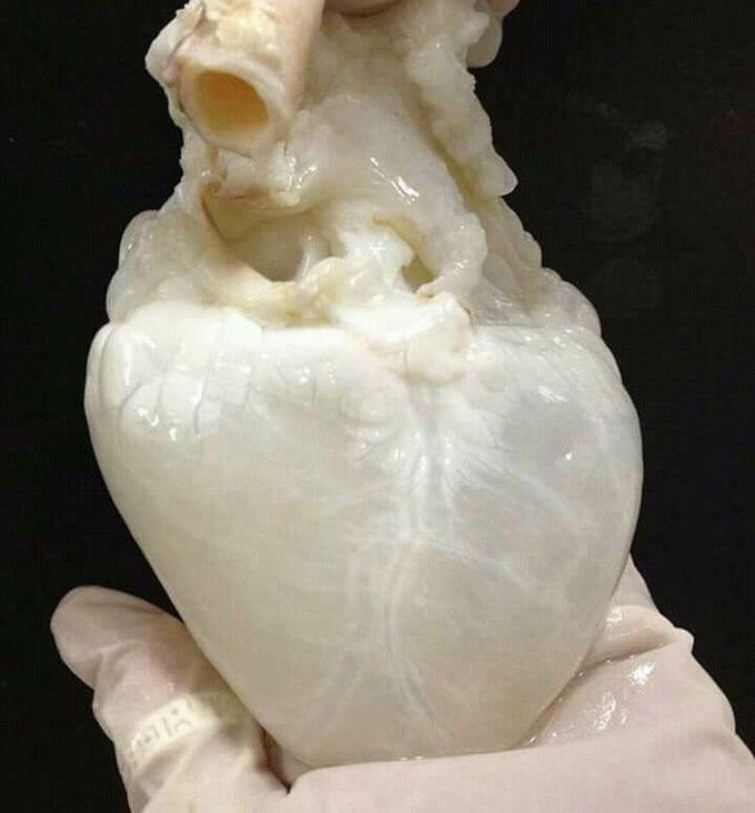 This is a human ❤ heart drained of all the blood