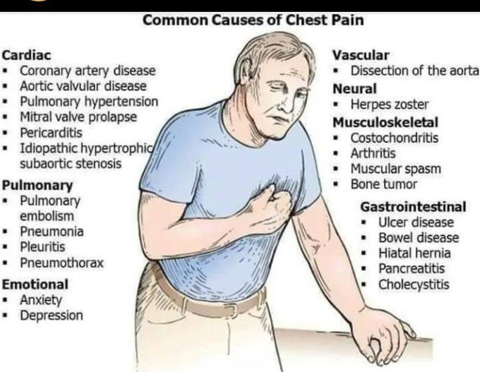 Chest pain common causes
