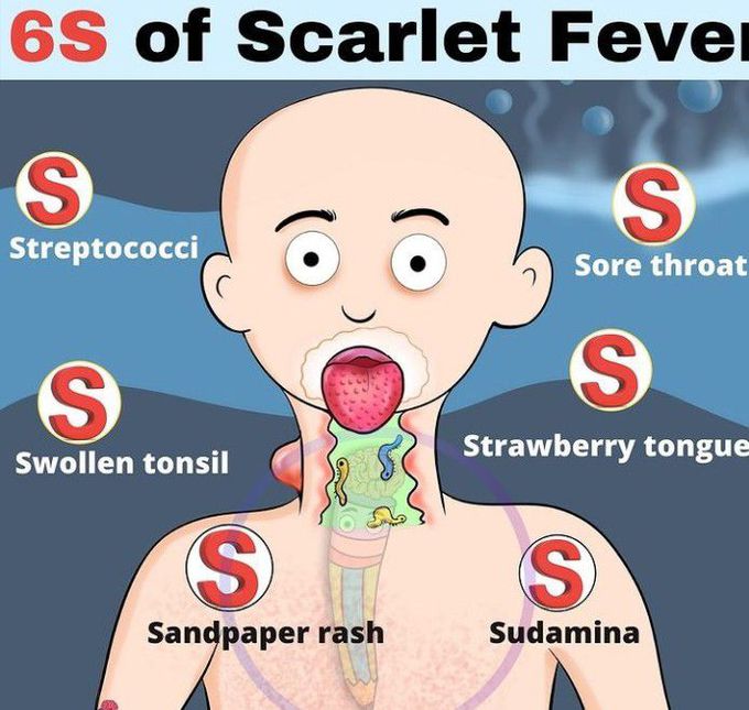 Symptoms of scarlet fever