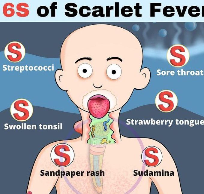 Symptoms Of Scarlet Fever Medizzy