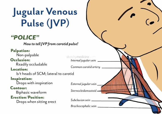 Jugular Venous Pulse Medizzy