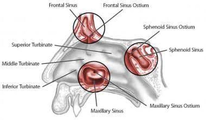 Turbinectomy