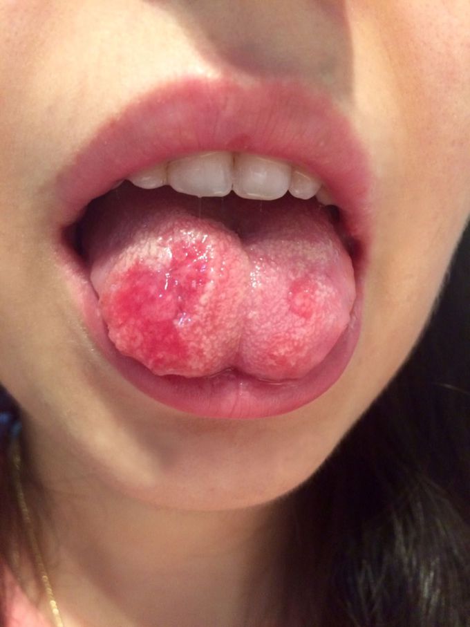 What is your diagnosis?