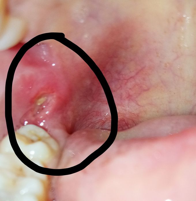 Diagnosis nd treatment please