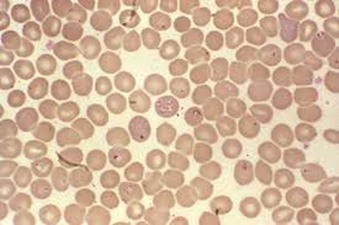 Causes of babesiosis