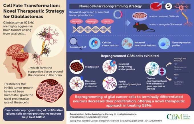 Converting Glioma Cells Into Neurons May Treat Glioblastoma - Neuroscience News