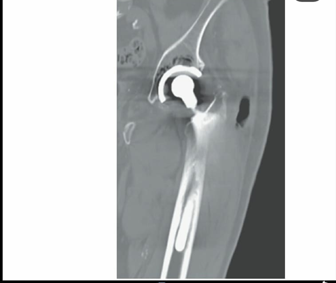 Diagnosis????
