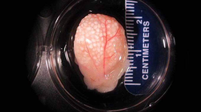 3D printed Artificial Ovaries - New doors to fertility