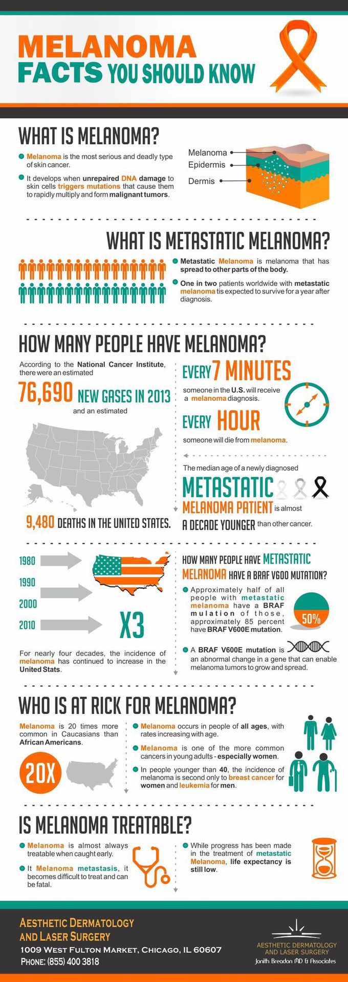 melanoma