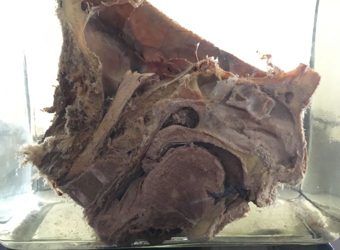 Sagital section of the head.