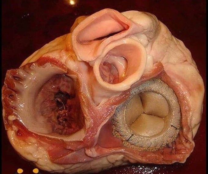 A  magnificent view of heart valves