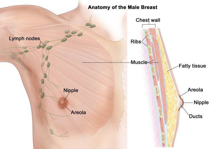 Breast cancer (male)
