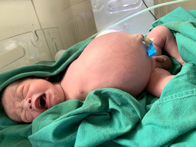 Neonatal
