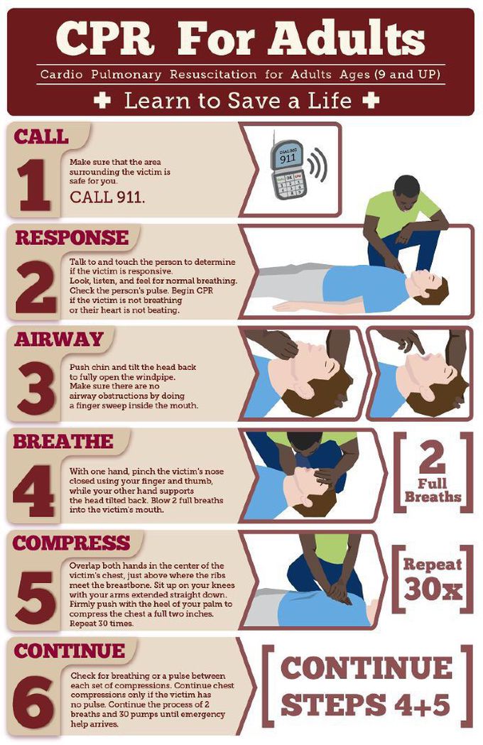 Cpr for an adult medizzy