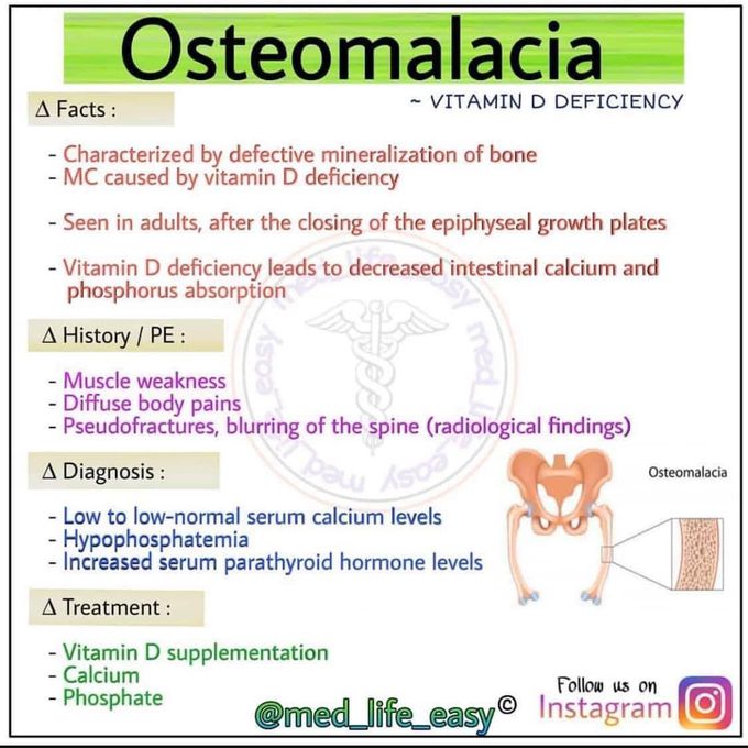 Osteomyelitis