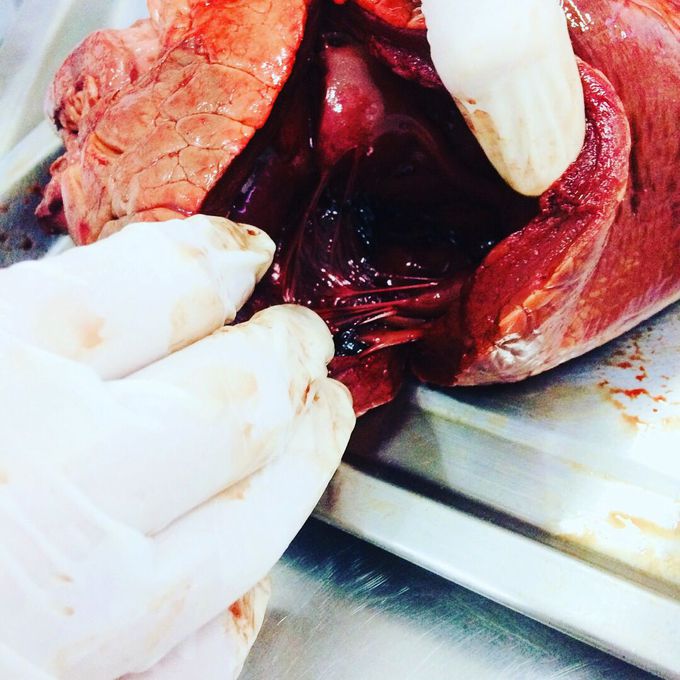 Dissecacion ❤️