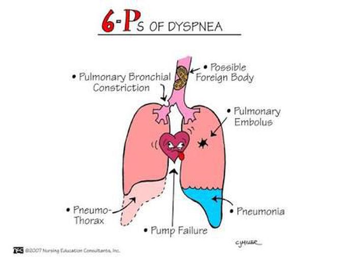 Causes of Dyspnea