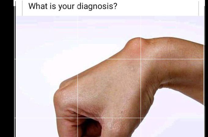 What's your diagnosis