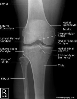 Xray knee - MEDizzy