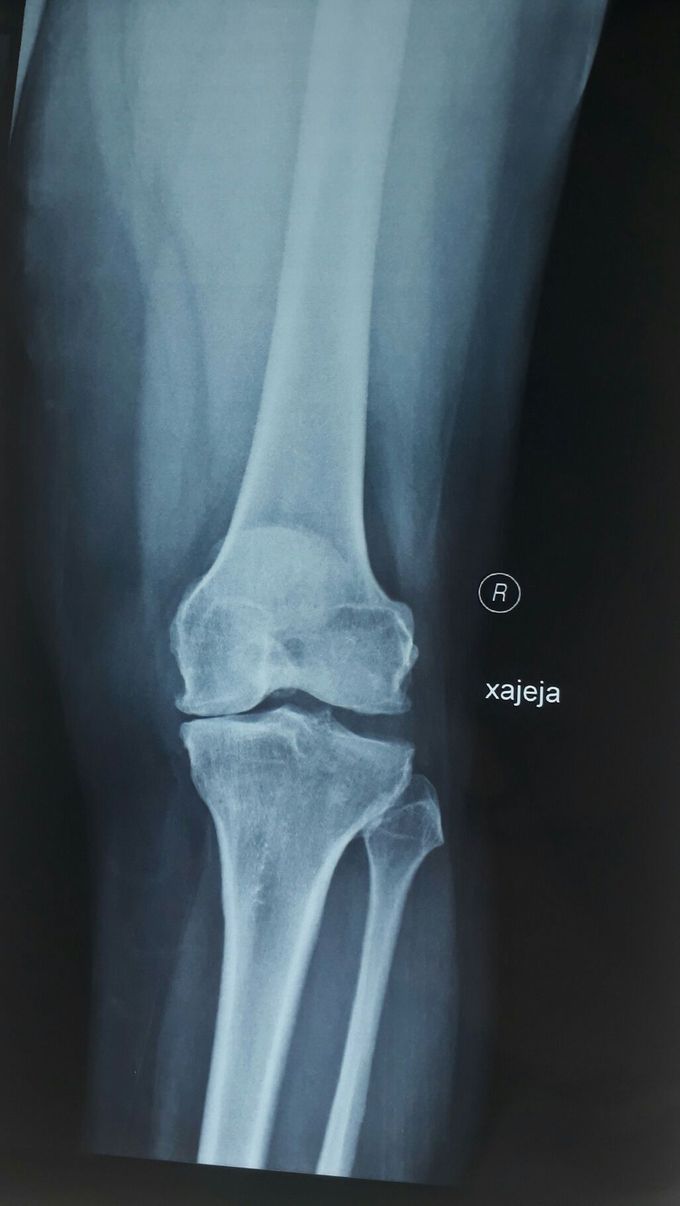 X- Ray