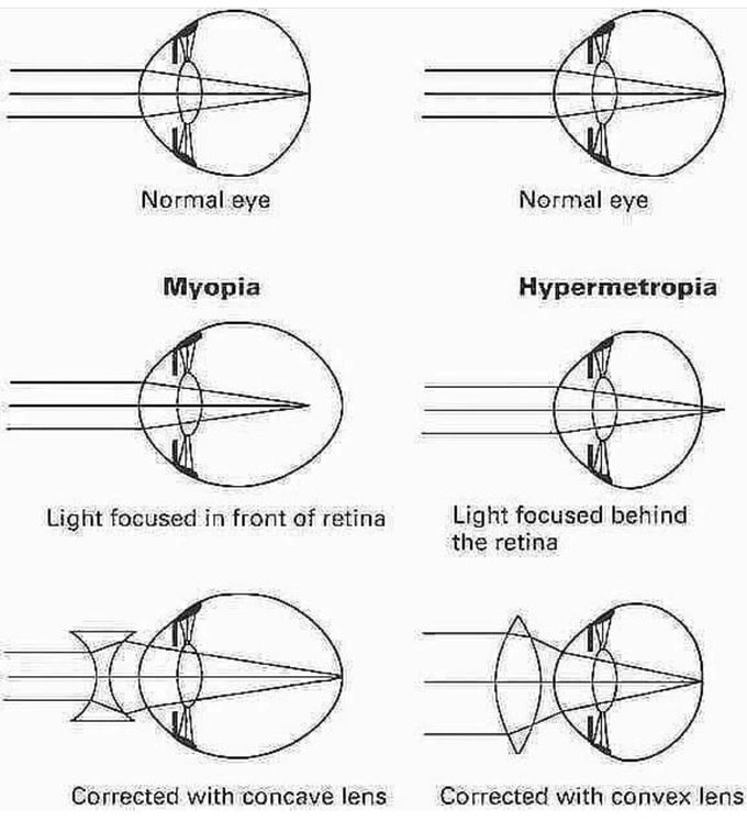 Common Refractory Disorders