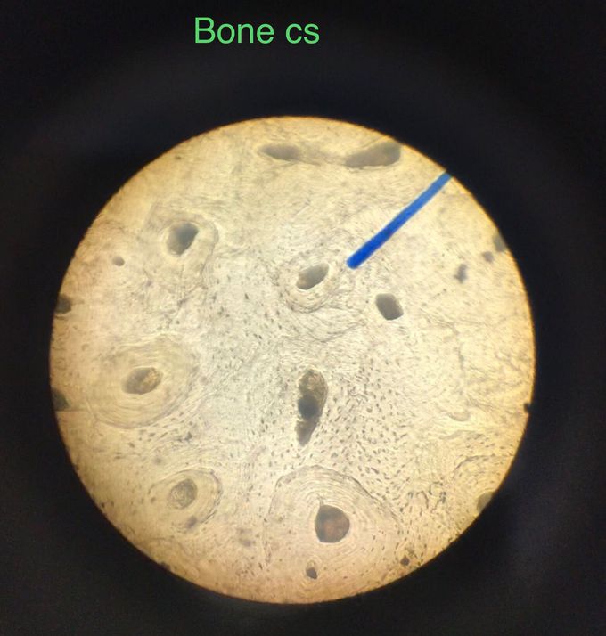 Microscopic structure of Bone