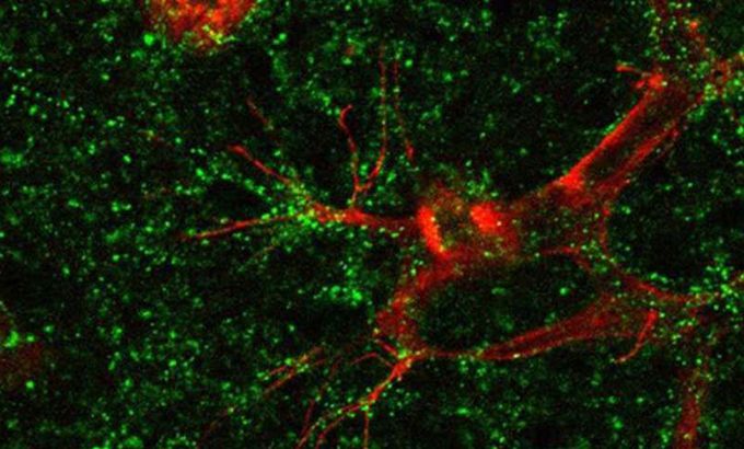 Common retinal diseases meet their match!