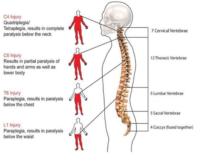 Spinal cord injury