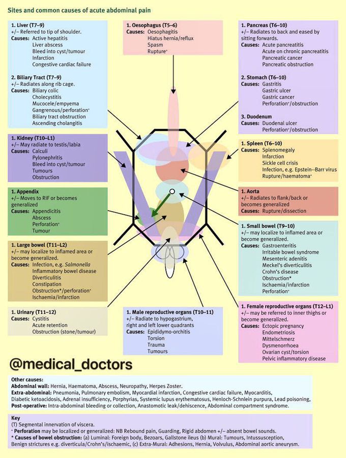 Site and causes of acute abdominal pain
