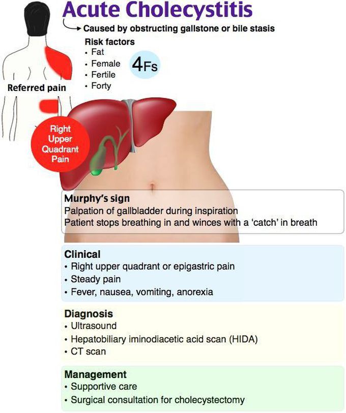 Acute cholicystitis