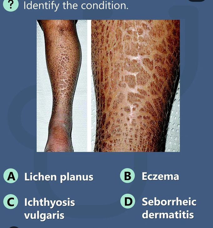 Identify the Condition