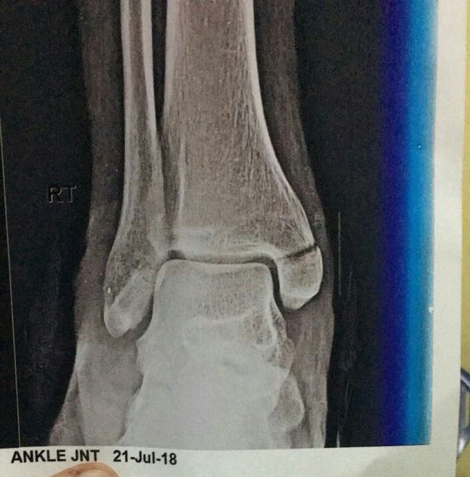 Orthopedic