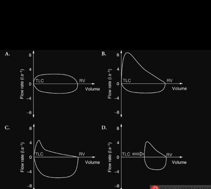 ##MCQ CHALLENGE