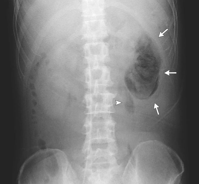 X_Ray