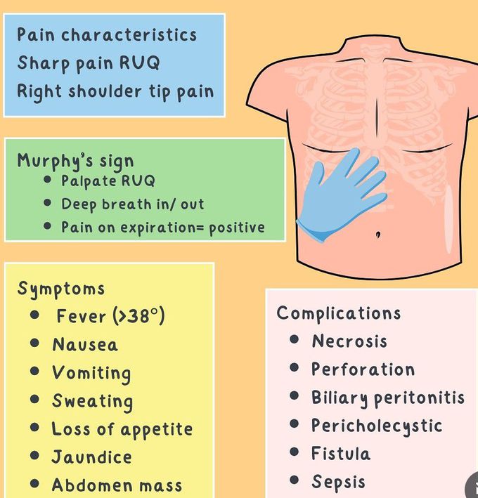 Cholecystitis II