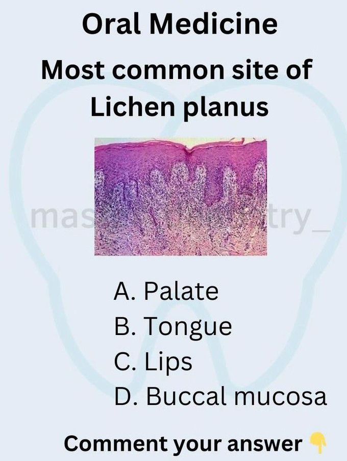 Lichen Planus