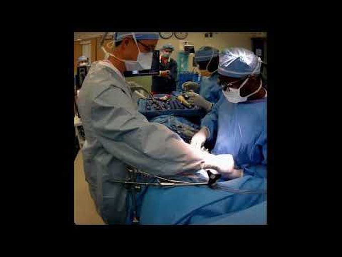 Navigated oblique lumbar interbody fusion for adult spinal deformity