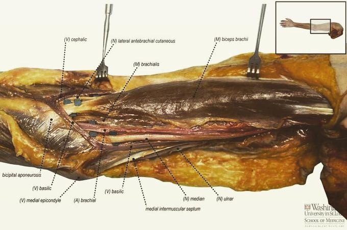 Amazing dissection of the arm