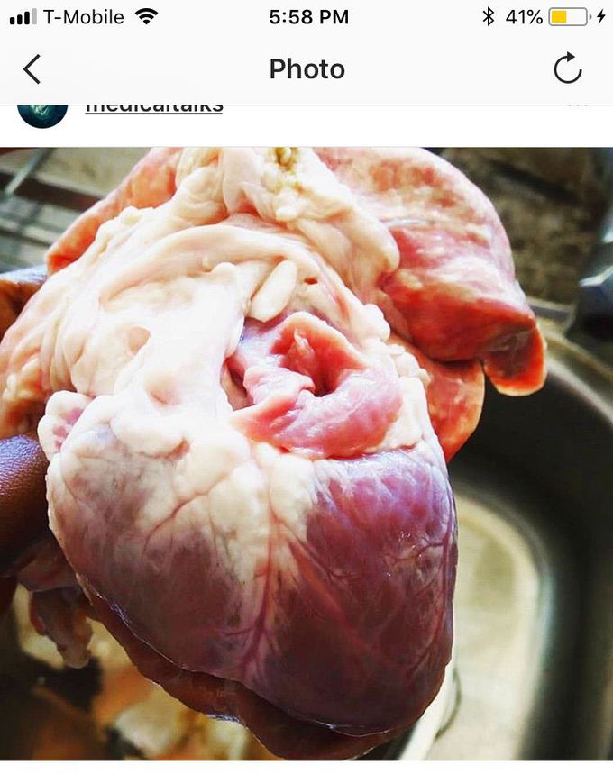 Heart