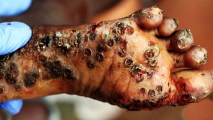 Diagnosis? 