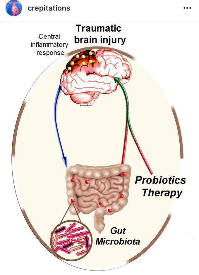 Traumatic Brain Injury