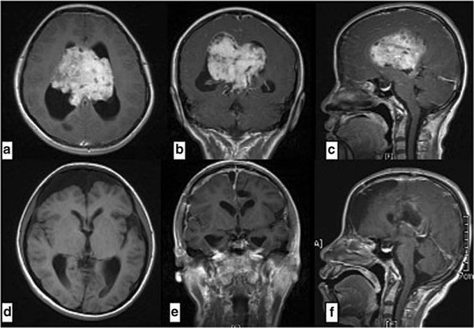 Can you identify this abnormally and treatment?